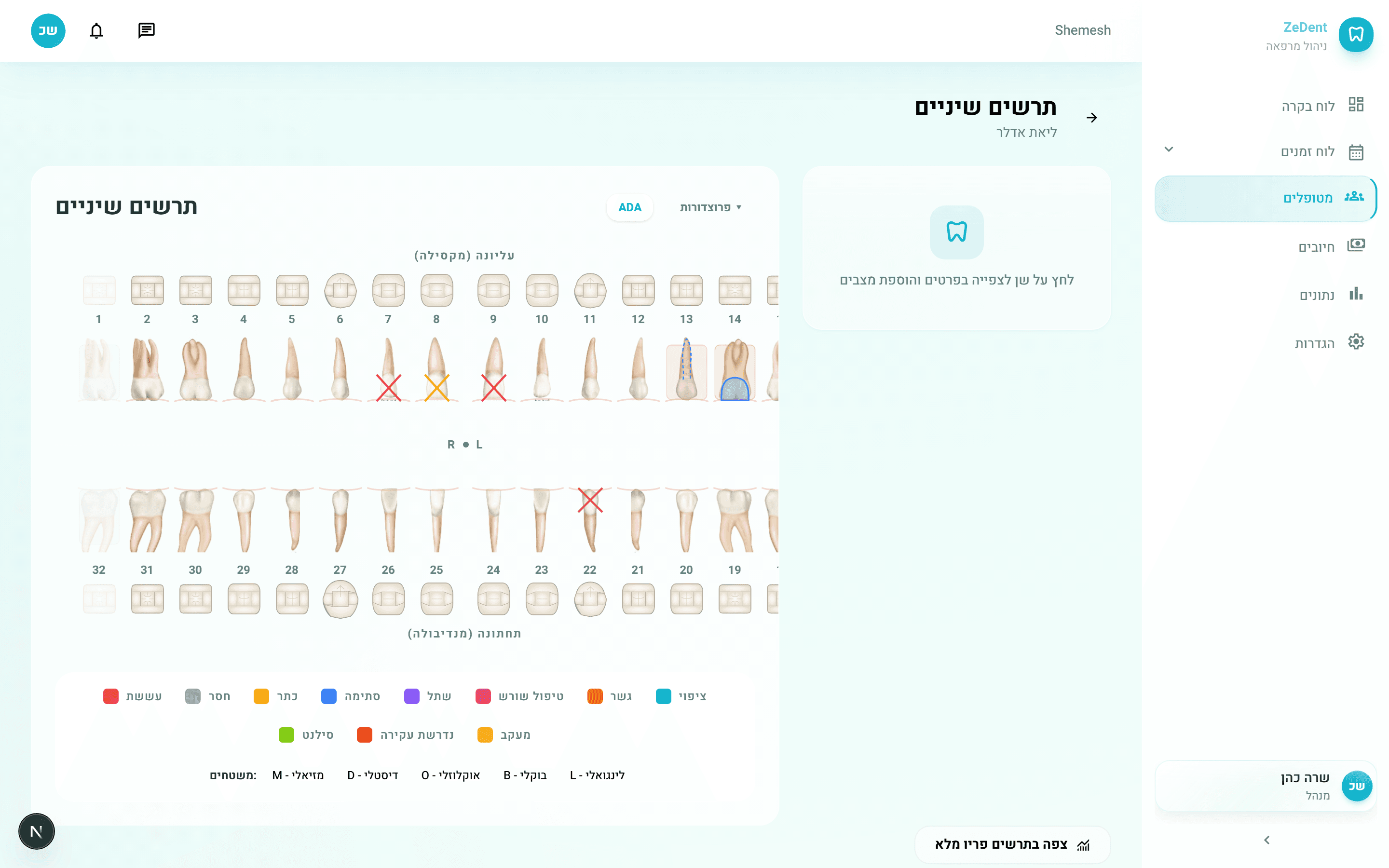 תרשים שיניים דיגיטלי של ZeDent - ויזואליזציה אינטראקטיבית של מצב שיניים וטיפולים
